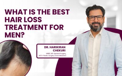 What Is the Best Hair Loss Treatment for Men?