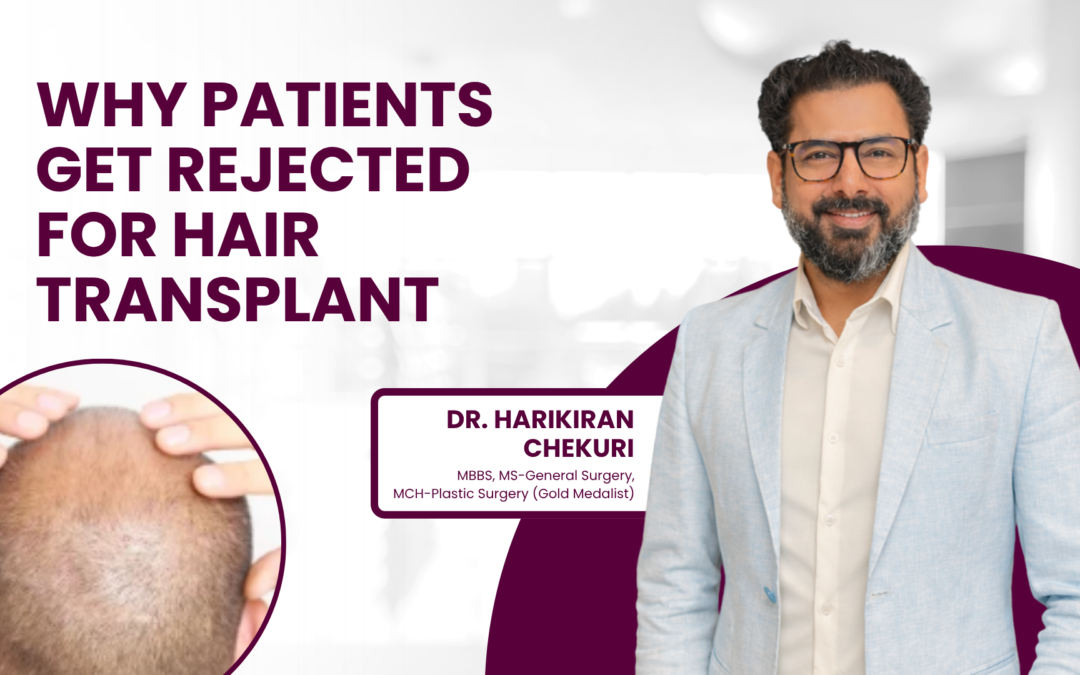 Why Patients Get Rejected for Hair Transplant