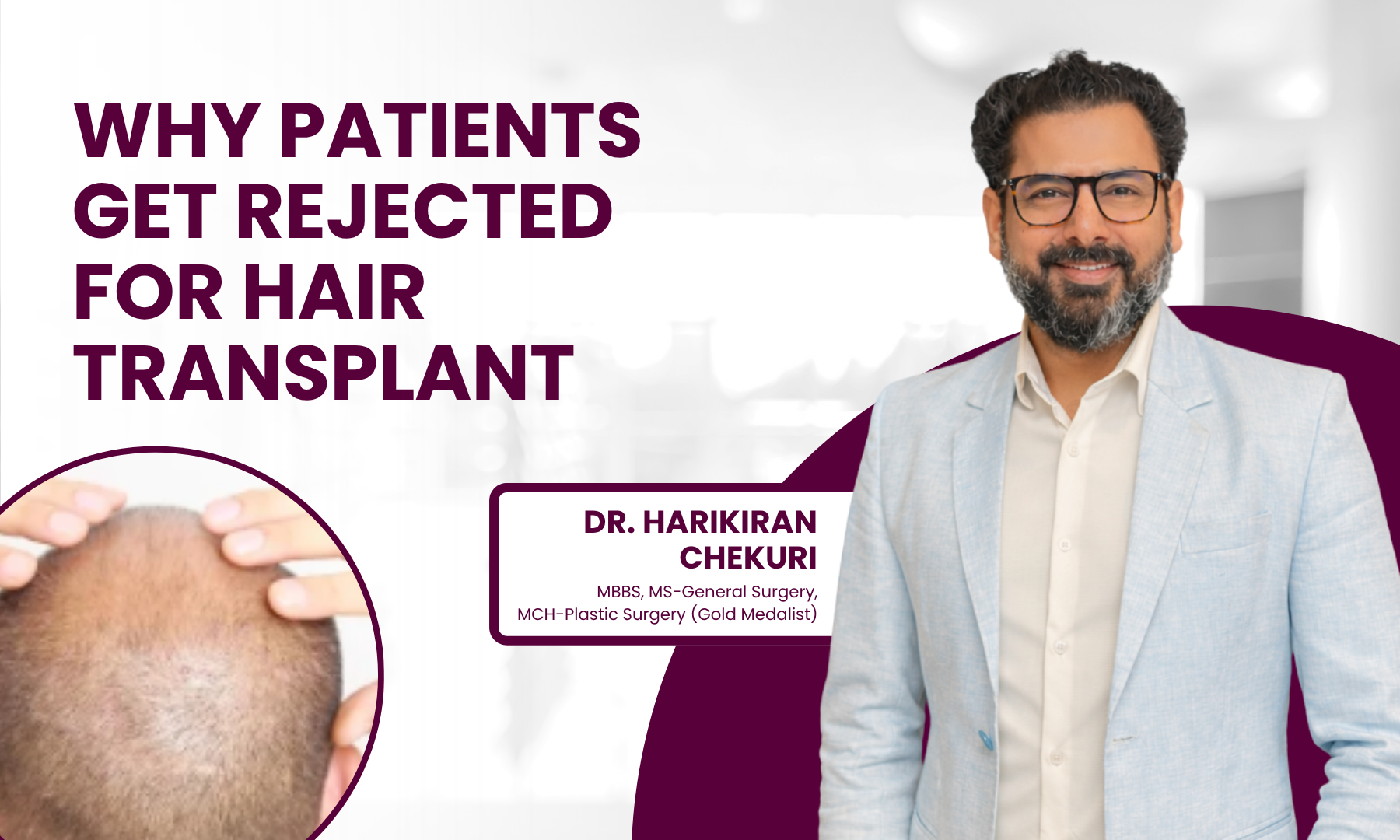 Banner for an article: 'Why patients get rejected for hair transplant' with a smiling doctor in a light suit on the right and a circular close-up of a bald head on the left.