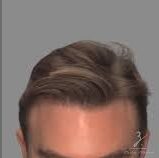 Side-by-side close-ups of a man’s head showing a short, textured style on the left and a smooth, swept style on the right, illustrating two hair looks.