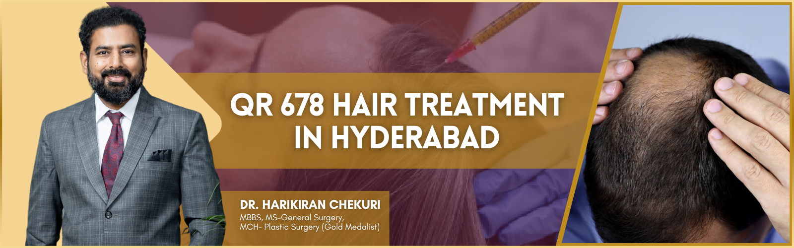 Banner promoting QR 678 Hair Treatment in Hyderabad with Dr. Harikiran Chekuri; doctor on left, scalp image on right.