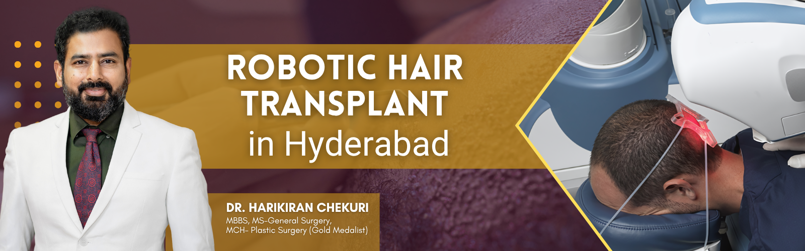 Robotic Hair Transplant in Hyderabad