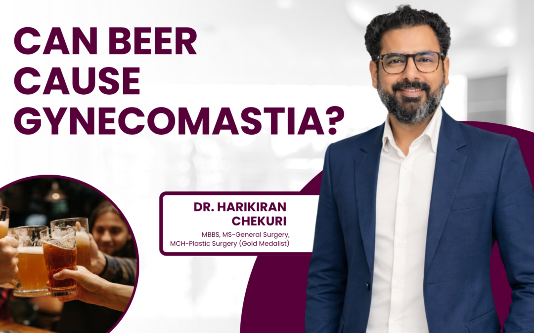 Can Beer Cause Gynecomastia?