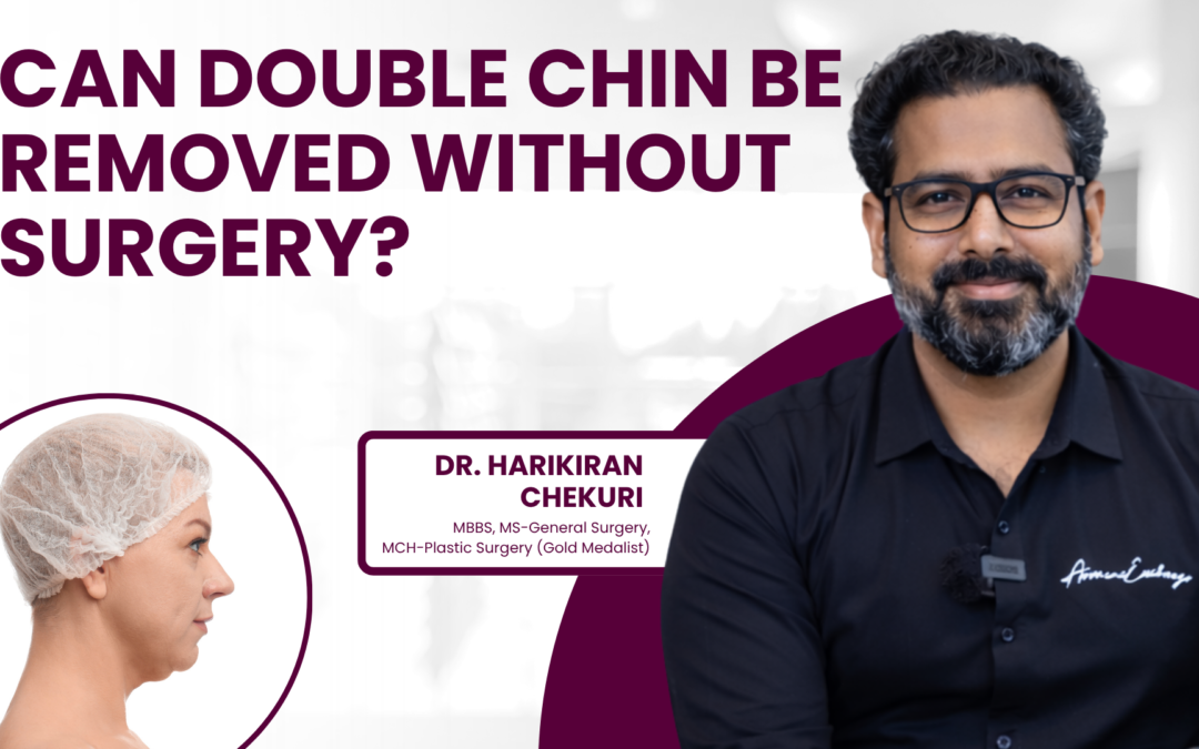 Can Double Chin Be Removed Without Surgery?