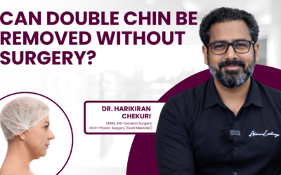 Can Double Chin Be Removed Without Surgery?