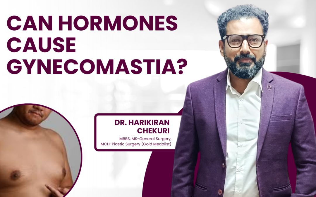 Can Hormones Cause Gynecomastia?