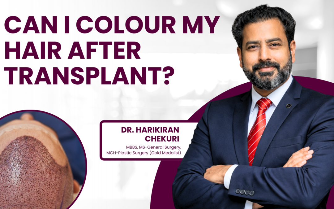 Can I Colour My Hair After Transplant?