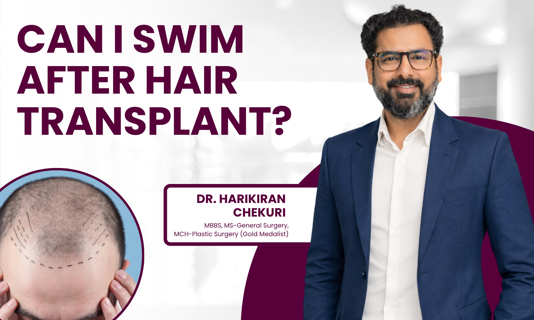 Can I Swim After Hair Transplant - Dr. Harikiran Chekuri
