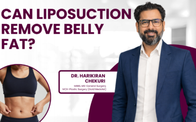 Can Liposuction Remove Belly Fat?