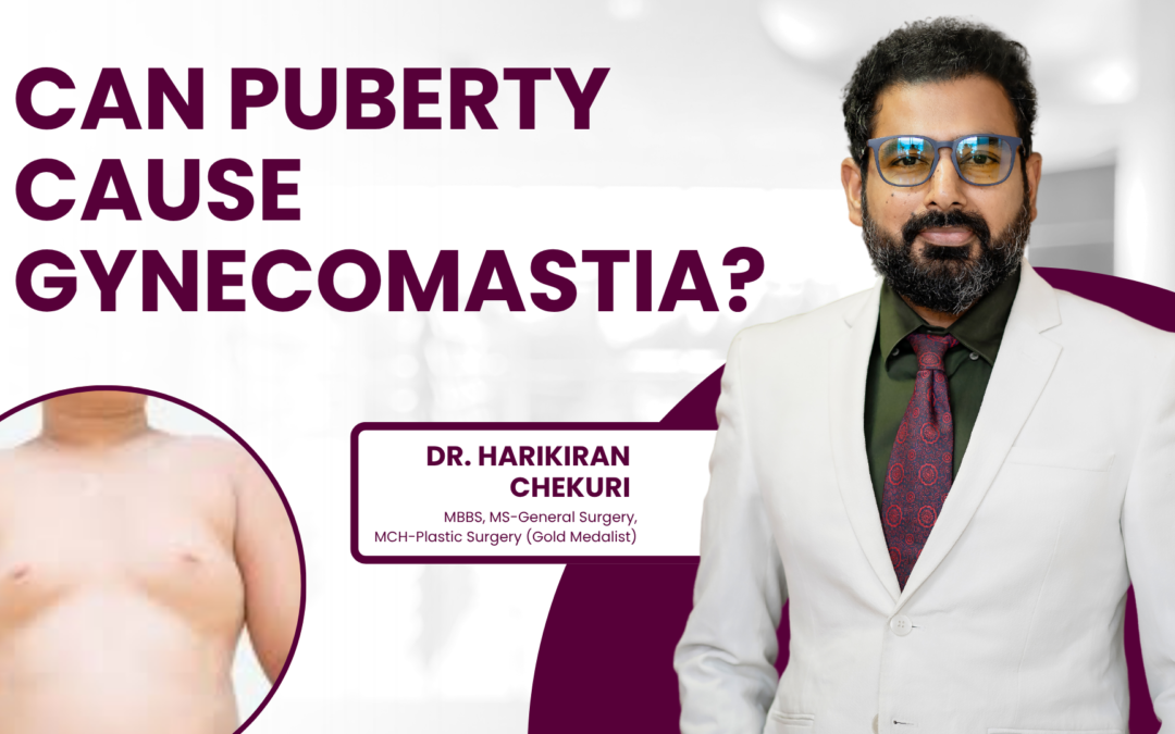 Can Puberty Cause Gynecomastia?