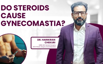 Do Steroids Cause Gynecomastia?