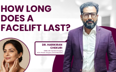 How Long Does a Facelift Last?