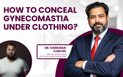 How to Conceal Gynecomastia Under Clothing?