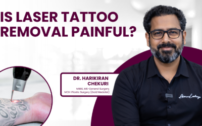 Is Laser Tattoo Removal Painful?