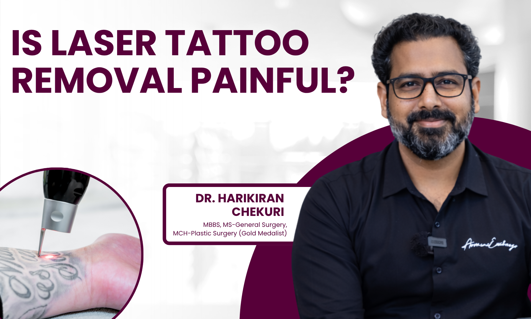Is Laser Tattoo Removal Painful | Redefine Is Laser Tattoo Removal Painful - Dr. Harikiran Chekuri