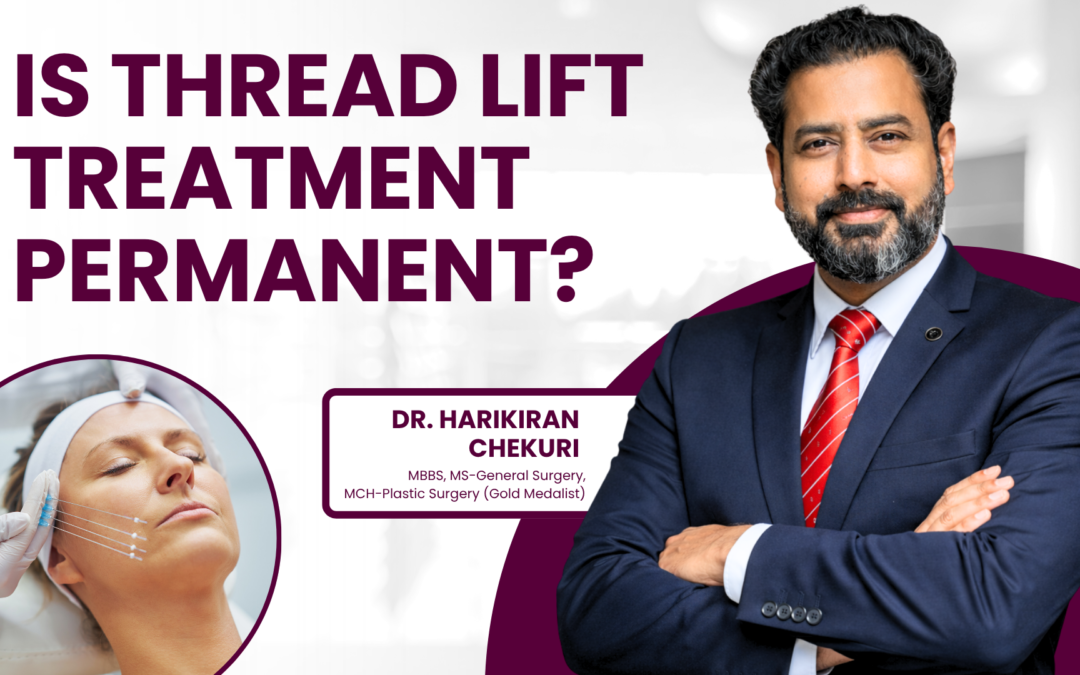 Is Thread Lift Treatment Permanent?