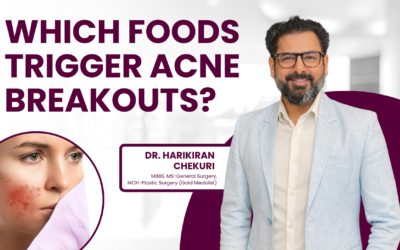 Which Foods Trigger Acne Breakouts?