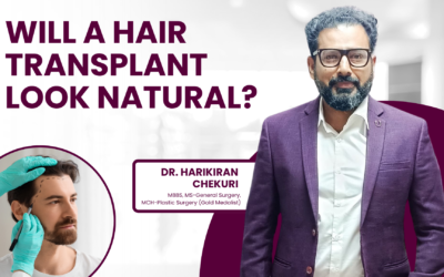 Will a Hair Transplant Look Natural?