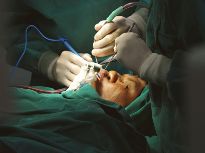 Surgeons performing an operation on a patient; close-up of hands with surgical instruments over a patient draped in green in an operating room