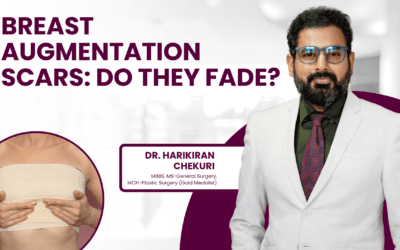 Breast Augmentation Scars: Do They Fade?