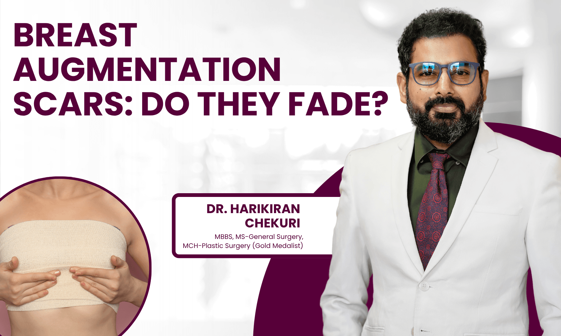 Breast Augmentation Scars Do They Fade
