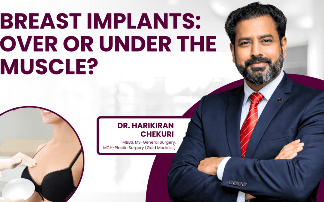 Breast Implants: Over or Under the Muscle?