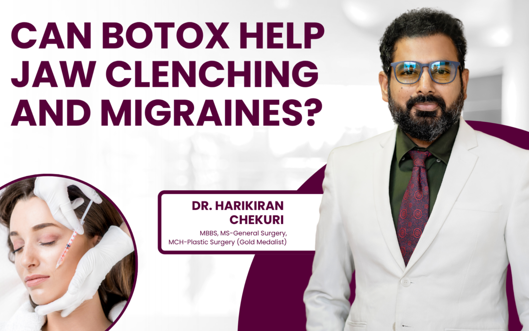Can Botox Help Jaw Clenching and Migraines?