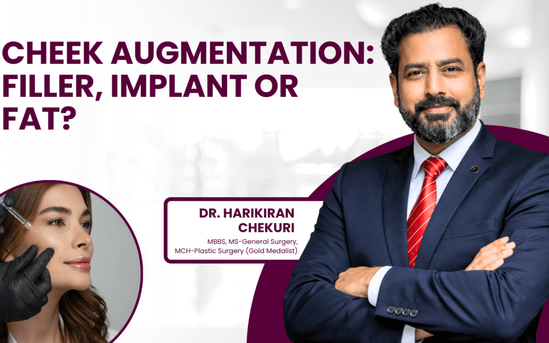 Cheek Augmentation: Filler, Implant or Fat?
