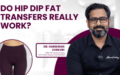 Lip Lift or Lip Filler: Which Is Better?