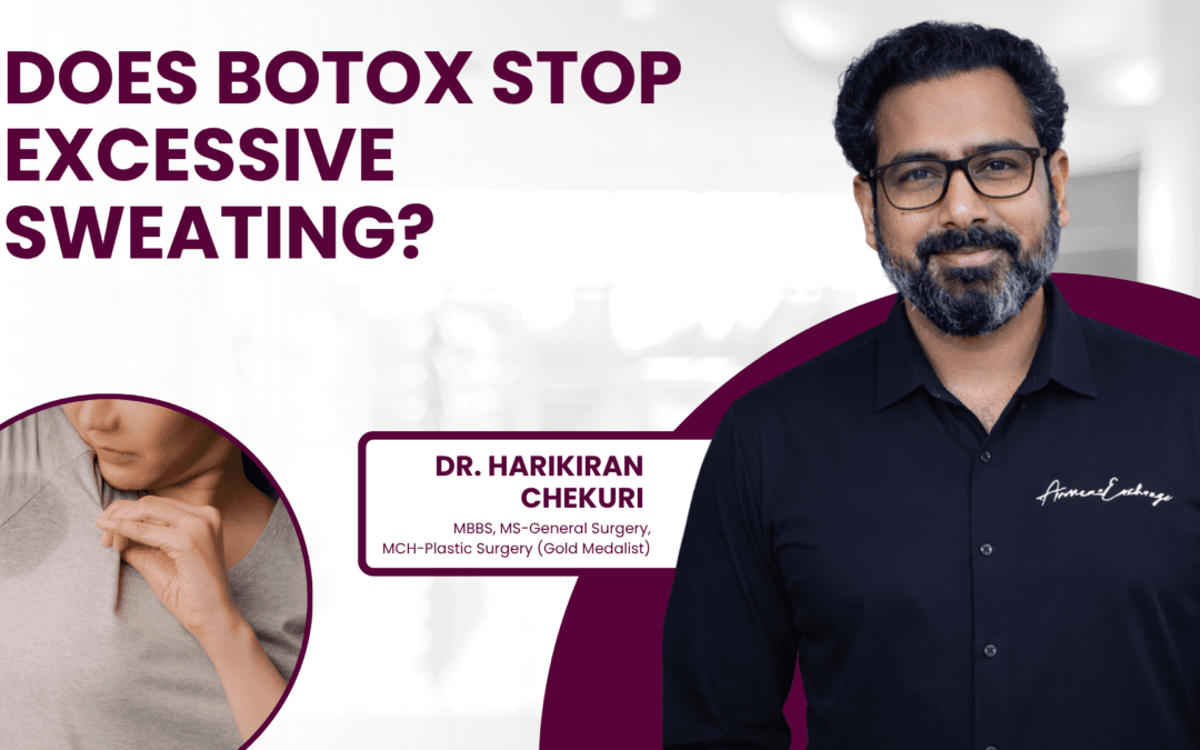 Does Botox Stop Excessive Sweating?