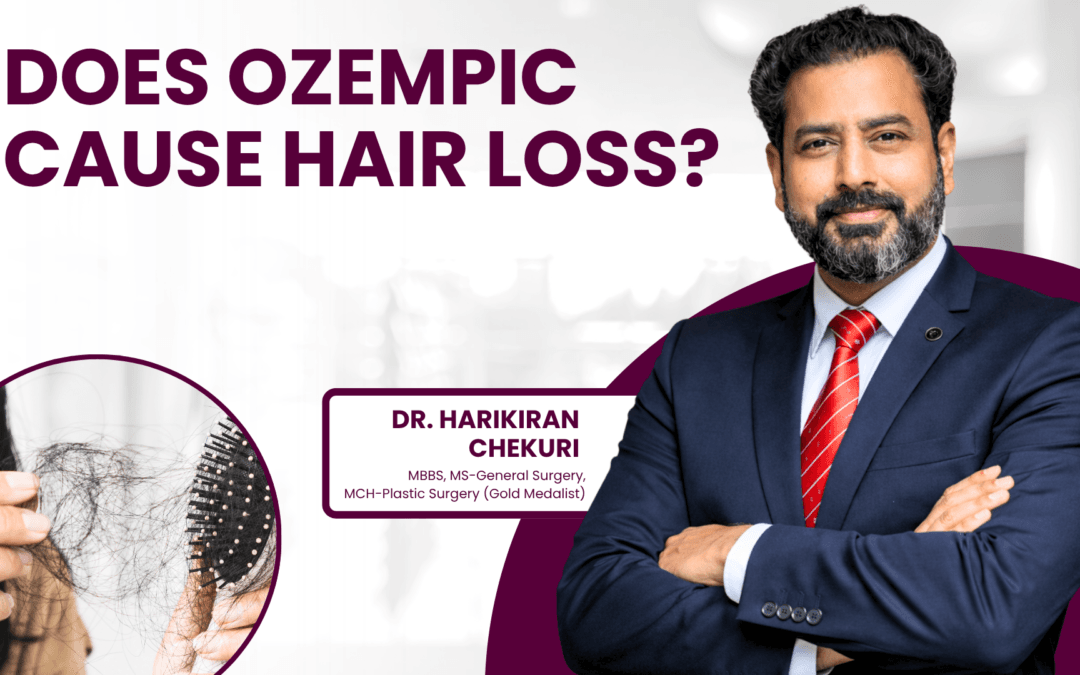 Does Ozempic Cause Hair Loss?