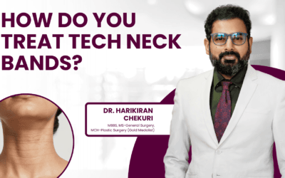How Do You Treat Tech Neck Bands?