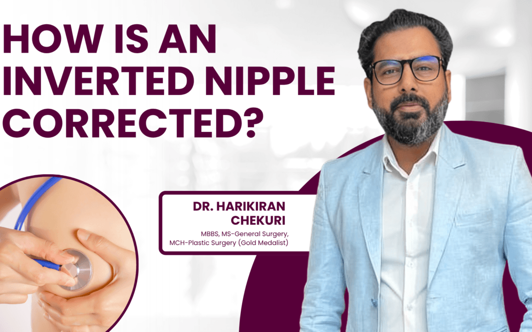 How Is an Inverted Nipple Corrected?