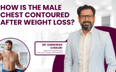 How Is the Male Chest Contoured After Weight Loss?