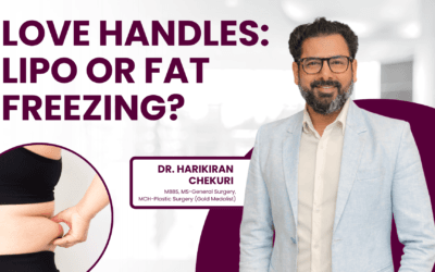 Love Handles: Lipo or Fat Freezing?