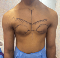 Front view of a person’s bare chest with tattoo-like outlines: two curved shapes over the pecs connected by a vertical line down the center.