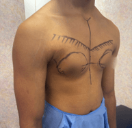Shirtless person in blue shorts with a large cross‑like chest tattoo: a vertical center line and curved shapes over the chest with winged lines extending toward the shoulders.