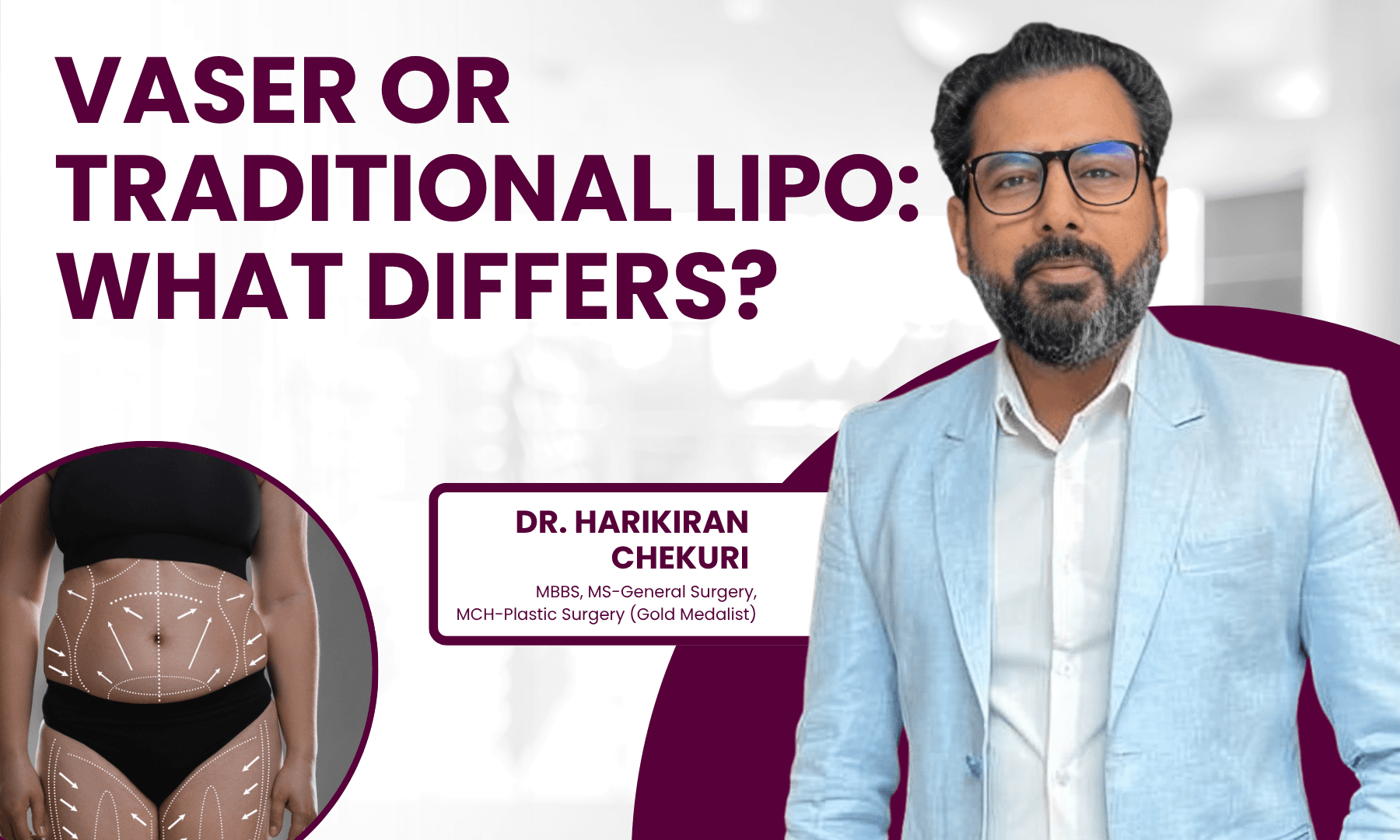 VASER or Traditional Lipo What Differs