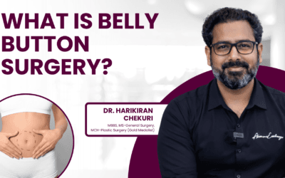 What Is Belly Button Surgery?