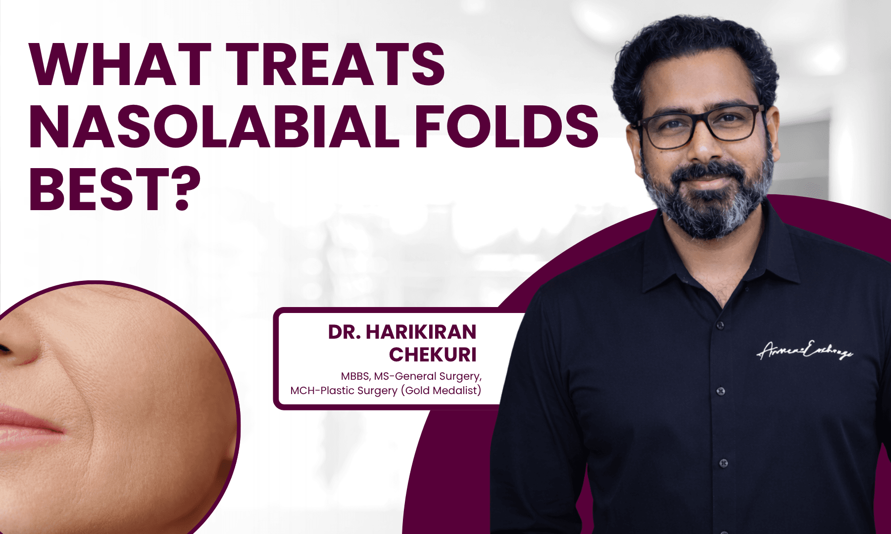 What Treats Nasolabial Folds Best