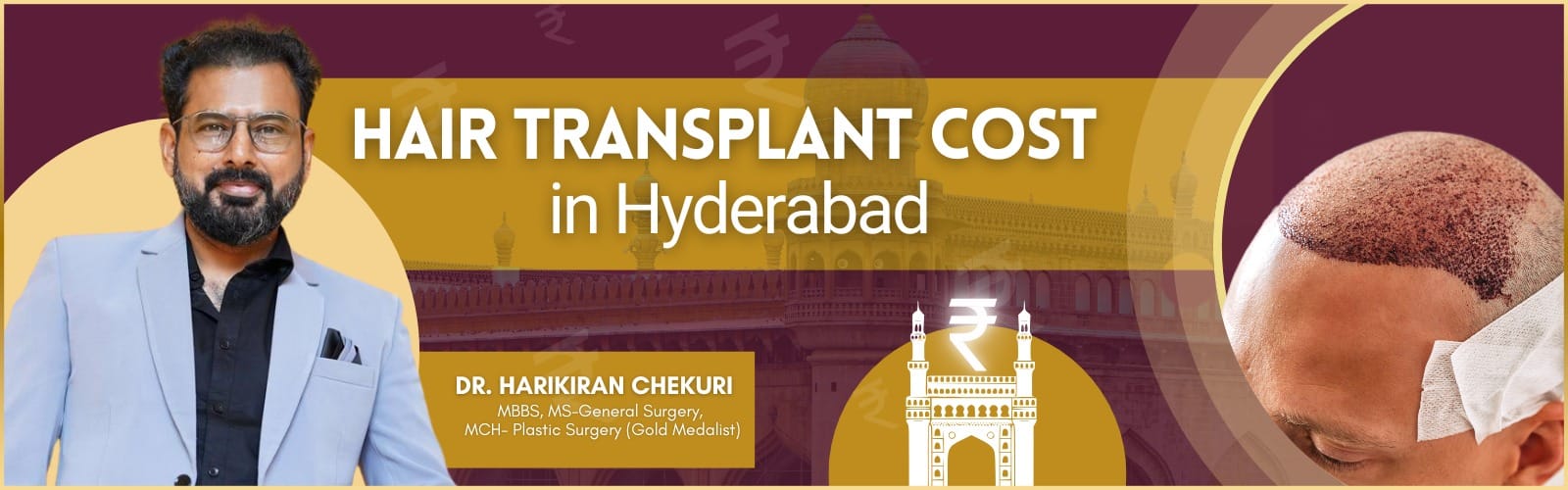 Banner for hair transplant cost in Hyderabad featuring Dr. Harikiran Chekuri on the left and a balding man on the right, with architectural visuals in the background.