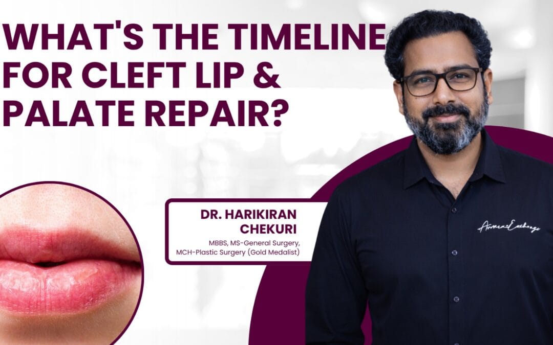 What’s the Timeline for Cleft Lip & Palate Repair?