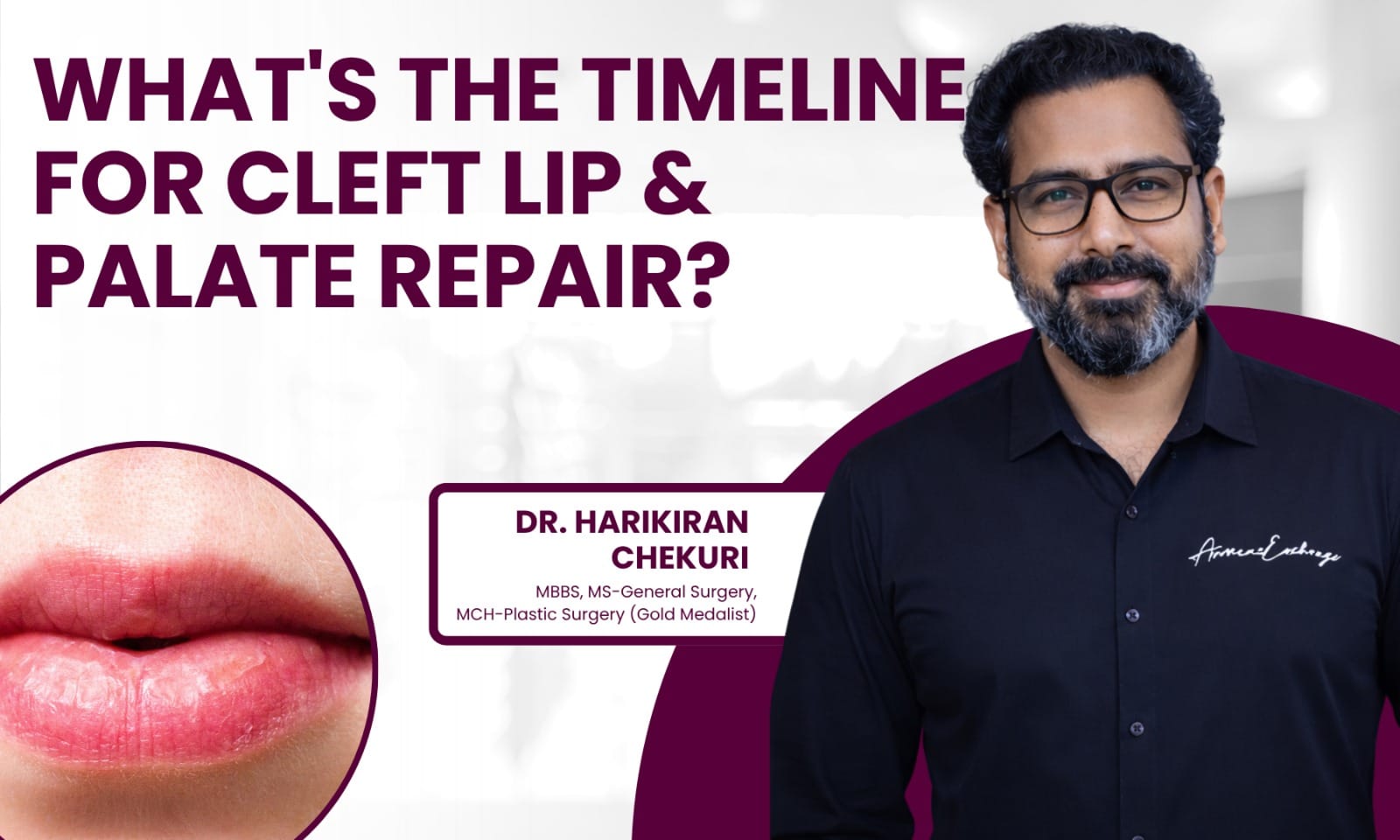 What's the Timeline for Cleft Lip and Palate Repair | Redefine What's the Timeline for Cleft Lip and Palate Repair – Dr. Harikiran Chekuri