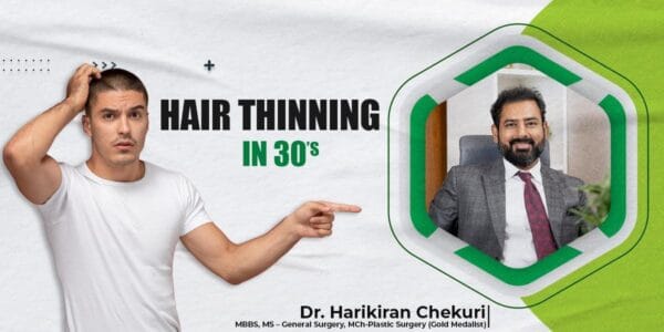 Promotional banner for hair thinning treatment in the 30s, featuring a man pointing at the text and a doctor in a green-framed portrait on the right.