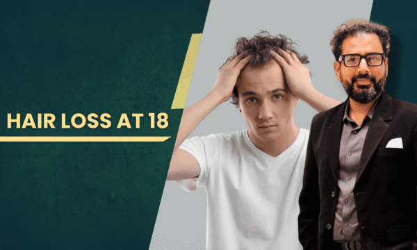 Young man in a white T-shirt holds his head in distress beside a suited man, with the text 'HAIR LOSS AT 18' on the left.