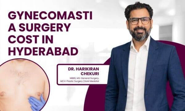 Promotional banner advertising gynecomastia surgery cost in Hyderabad, featuring Dr. Harikiran Chekuri and a man in a navy suit.