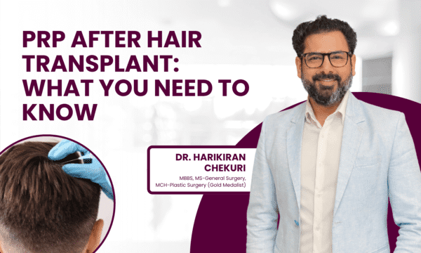 Informational banner about PRP after hair transplant, featuring Dr. Harikiran Chekuri and a bold headline; circular scalp treatment image on the left.