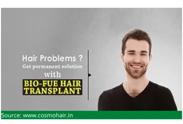 Smiling man beside an ad reading 'Hair Problems? Get permanent solution with BIO-FUE HAIR TRANSPLANT'.