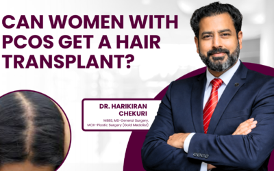 Can Women With PCOS Get a Hair Transplant?