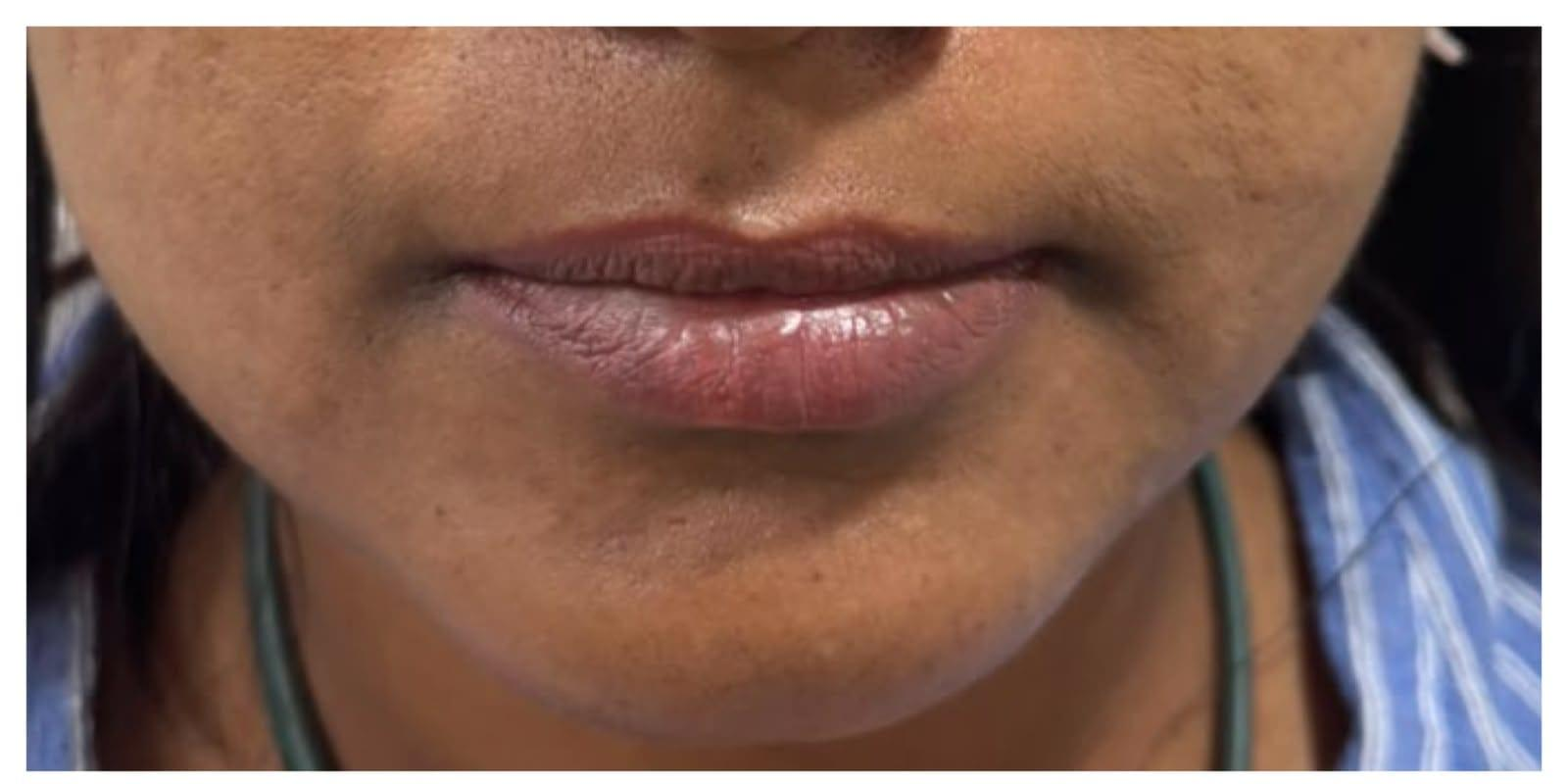 Close-up of a person’s lips and chin, with light facial stubble and a teal/green necklace visible at the neck.